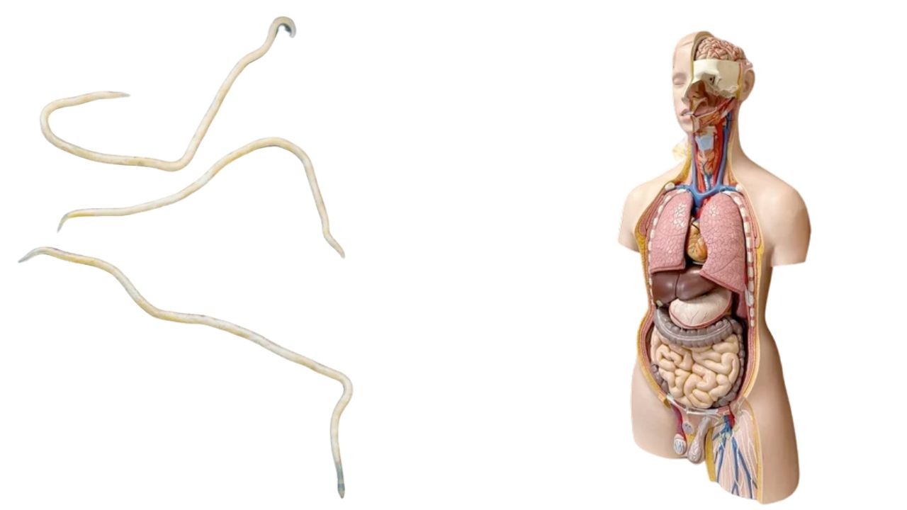 Worm Itiching Problem